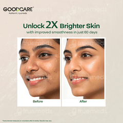 Goodcare Rice Water Foaming Face Wash 150ml